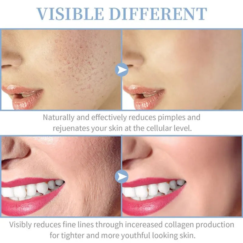Terapia Facial